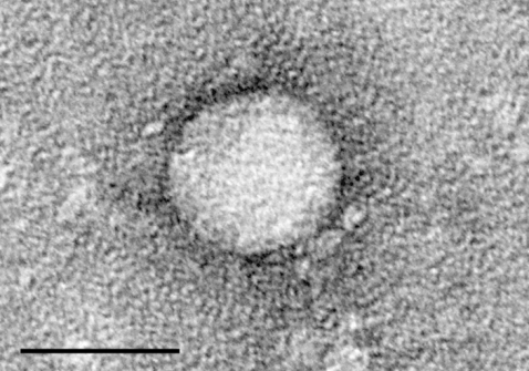 Virus dell'epatite C al microscopio (foto pubblico dominio)
