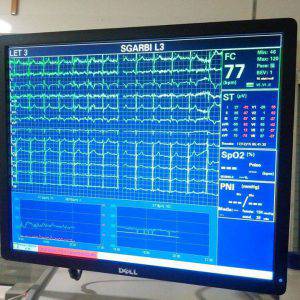 Ecg Sgarbi (Facebook )