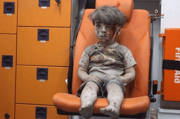 Omran Daqneesh (foto dal web)
