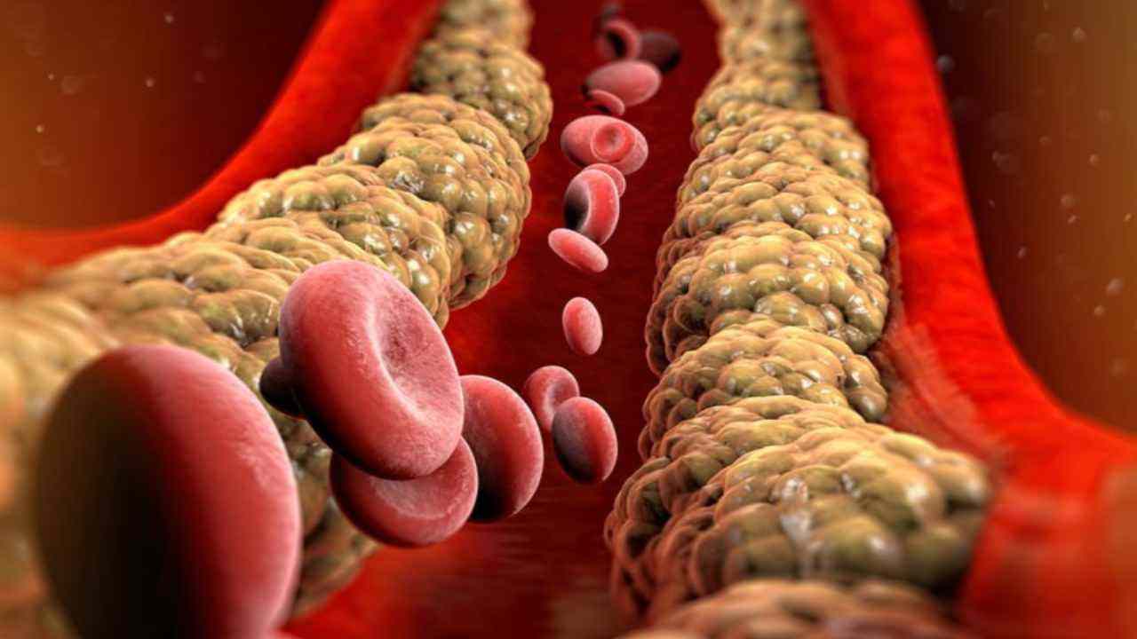Colesterolo nel sangue(Fonte Web)
