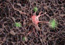 Malattia neurovegetativa(Fonte Web)